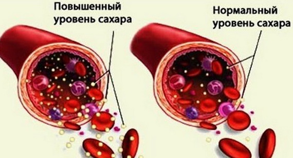 Разлози због којих се усне суше код жена, мушкараца. Како лечити прехладу, САРС, менопаузу, дијабетес, онкологију, током трудноће