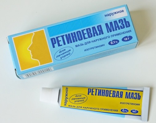 Како се решити митесера на лицу, носу, ушима. Производи са салицилном киселином, зубном пастом, пероксидом, активним угљем
