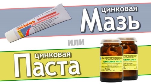 Како се решити митесера на лицу, носу, ушима. Производи са салицилном киселином, зубном пастом, пероксидом, активним угљем