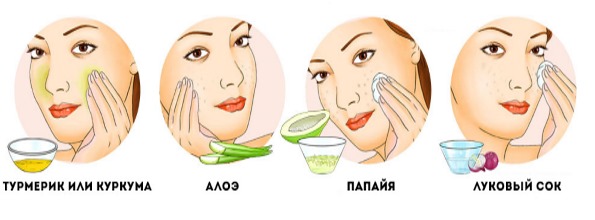علاجات للبقع العمرية على الوجه واليدين. وصفات شعبية ، مستحضرات صيدلية ، كريمات: Melanativ ، Vichy ، Sabainang. كيفية التقديم