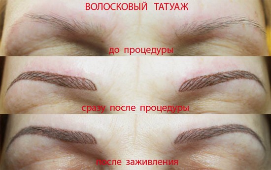 Xăm lông mày: phương pháp lông. Ưu nhược điểm, chống chỉ định, tính năng thực hiện, ảnh trước và sau