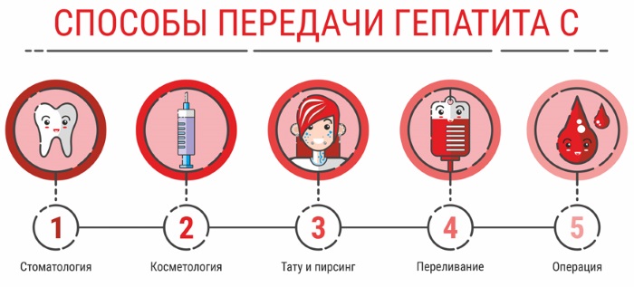 Tạo bóng vĩnh viễn trên mí mắt. Ảnh, như được thực hiện cho mí mắt dưới, trên, với bóng đổ, hiệu ứng mắt khói, mũi tên cổ điển