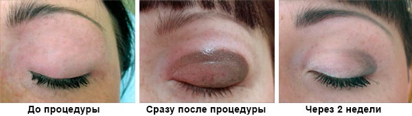 Bóng trang điểm vĩnh viễn trên mí mắt. Ảnh, như được thực hiện cho mí mắt dưới, trên, với bóng đổ, hiệu ứng mắt khói, mũi tên cổ điển