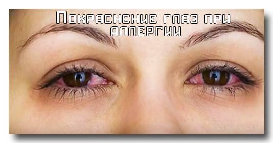 Quầng thâm dưới mắt, quầng thâm quanh mắt. Nguyên nhân và cách điều trị ở phụ nữ và nam giới