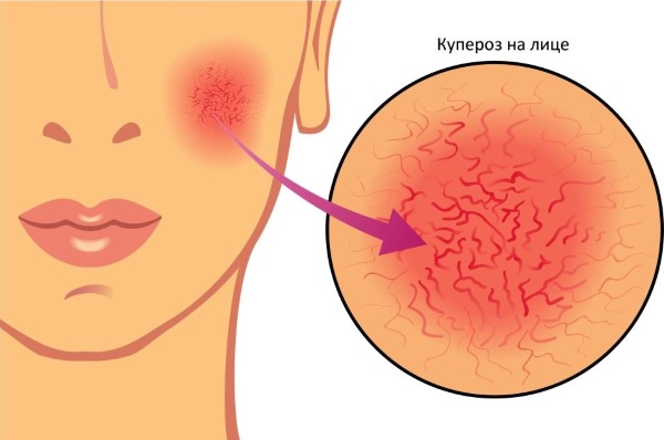 Kem Cyclim cho mặt để có tác dụng thực vật. Hướng dẫn sử dụng, đánh giá của chuyên gia thẩm mỹ. Làm sao để đăng kí