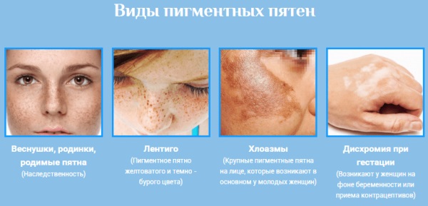 Kem Achromin cho các đốm đồi mồi. Nhận xét của bác sĩ, hướng dẫn sử dụng, chỉ định và chống chỉ định, hình ảnh trước và sau