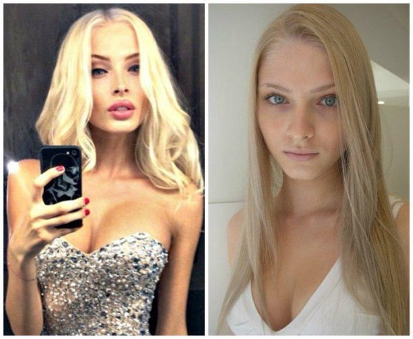 Alena Shishkova. Hình ảnh trước và sau khi phẫu thuật thẩm mỹ. Tiểu sử, hoạt động mô hình, thông số hình