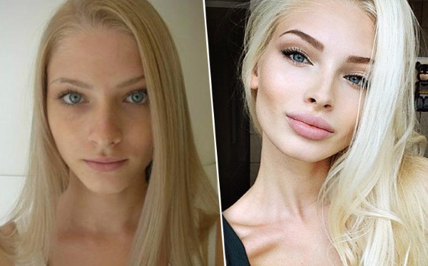 Alena Shishkova. Hình ảnh trước và sau khi phẫu thuật thẩm mỹ. Tiểu sử, hoạt động mô hình, thông số hình