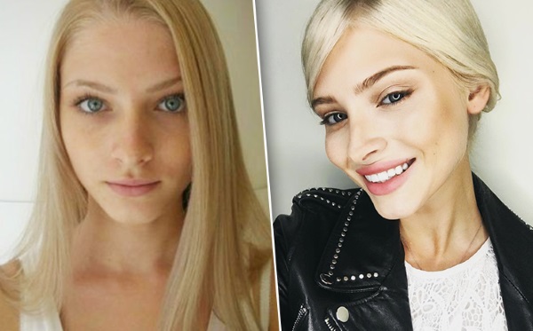 Alena Shishkova. Hình ảnh trước và sau khi phẫu thuật thẩm mỹ. Tiểu sử, hoạt động mô hình, thông số hình