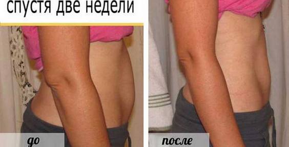 Bọc cơ thể chống cellulite với dầu, đất sét, mù tạt, mật ong, giấm, cà phê. Công thức, quy tắc sử dụng tại nhà