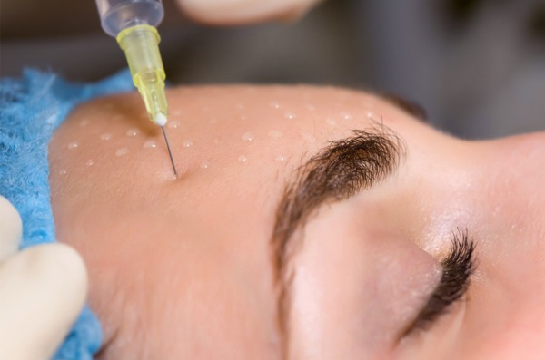 Liệu pháp Botulinum trong thẩm mỹ - nó là gì, hiệu quả và kết quả, đánh giá. Dysport, Xeomin, Botox