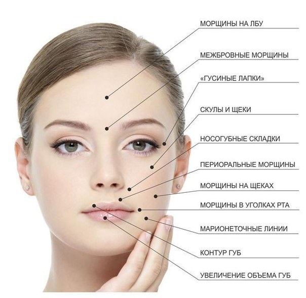 Liệu pháp Botulinum trong thẩm mỹ - nó là gì, hiệu quả và kết quả, đánh giá. Dysport, Xeomin, Botox