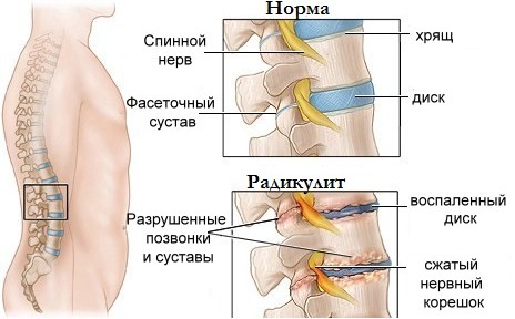 Darsonvalization - nó là gì trong thẩm mỹ, lợi ích của quy trình đối với da mặt, đầu, mí mắt, tóc, thiết bị. Chỉ định và chống chỉ định, hiệu quả