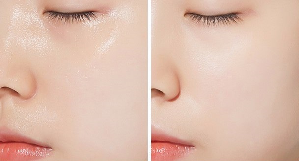 Enzyme lột: nó là gì, lợi ích cho da mặt: salicylic, có tính axit. Cách chọn những đánh giá tốt nhất