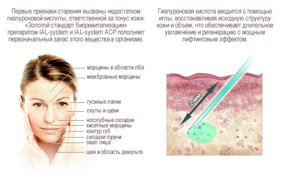 Gialripayer mesolift 02, 04, 06, 07, 08. Thành phần bioreparant, giá cả, đánh giá của bệnh nhân, chuyên gia thẩm mỹ