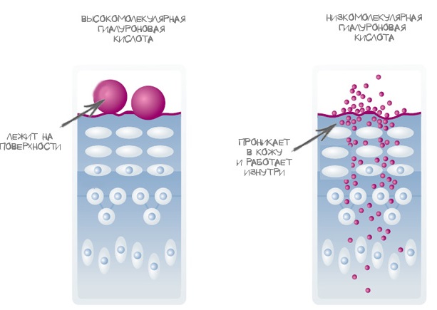 Axit hyaluronic cho môi: ảnh trước và sau, ưu nhược điểm, tác dụng, chống chỉ định. Giá thủ tục và đánh giá