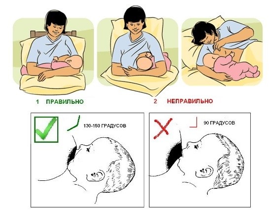 Ngực sau khi sinh con: cách làm săn chắc, đàn hồi, xóa rạn da. Tập thể dục, massage, mỹ phẩm