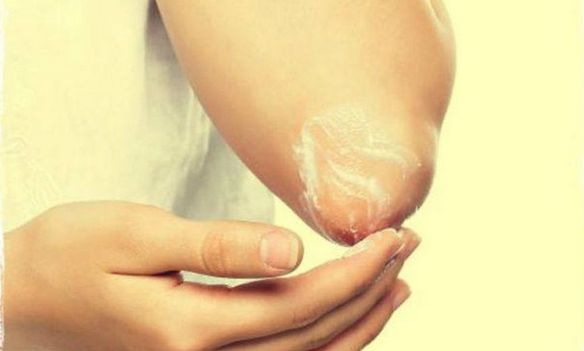 Cây lá móng không màu cho tóc: lợi ích và tác hại, phương pháp áp dụng, mặt nạ tăng cường và điều trị. Nhận xét