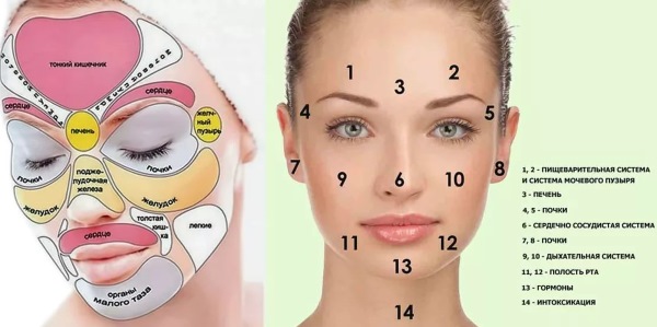 Miliums trên mặt. Ảnh, cách xóa, điều trị tại nhà, xóa bằng laser dưới mắt, trên mí mắt, cằm, toàn thân. Nguyên nhân ở người lớn và trẻ em
