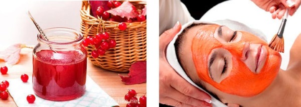 Miliums trên mặt. Ảnh, cách xóa, điều trị tại nhà, xóa bằng laser dưới mắt, trên mí mắt, cằm, toàn thân. Nguyên nhân ở người lớn và trẻ em