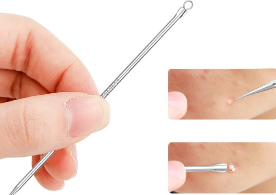 Miliums trên mặt. Ảnh, cách xóa, điều trị tại nhà, xóa bằng laser dưới mắt, trên mí mắt, cằm, toàn thân. Nguyên nhân ở người lớn và trẻ em