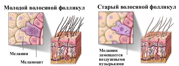 Како се ослободити сиве косе без бојења косе народним лековима, ракијом. Прави рецепти и митови