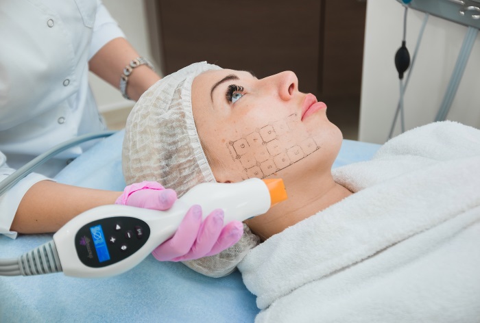 Colágeno para rostro, cuello y escote. Cosméticos: geles, cremas, sueros, champú, mascarilla. Cómo usar cápsula, líquida, bebible