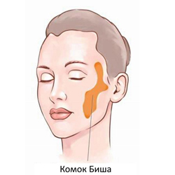 Loại bỏ các cục của Bisha. Ảnh trước và sau, hậu quả, thời gian phục hồi. Làm thế nào để loại bỏ mà không cần phẫu thuật
