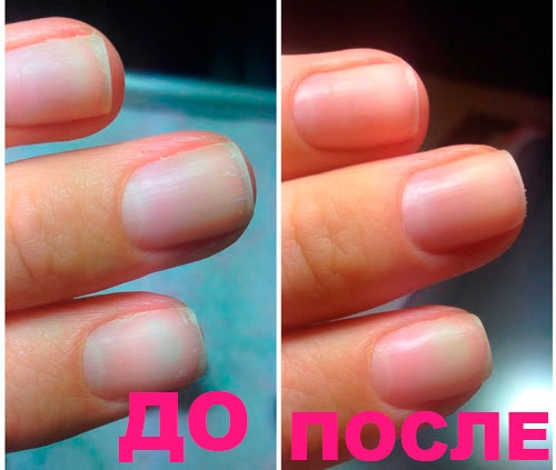 Ламинирање и јачање ноктију код куће. Алати и упутства