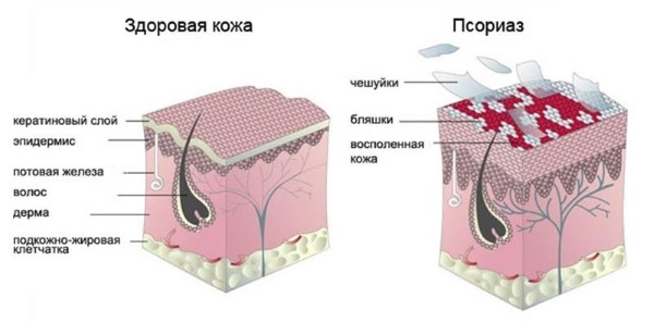 Како користити Левомекол за акне на лицу. Упутства, индикације и контраиндикације