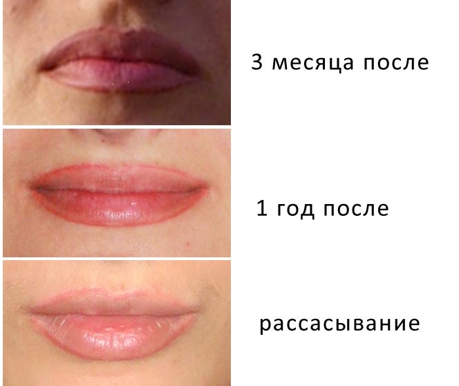 Trang điểm môi vĩnh viễn: với bóng mờ, hiệu ứng mở rộng, 3d, ombre, trong kỹ thuật màu nước, môi nhung. Ảnh trước và sau