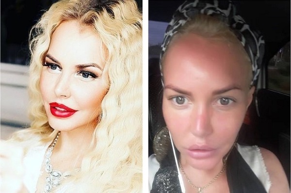 Masha Malinovskaya trước và sau khi phẫu thuật thẩm mỹ. Ảnh, tuổi, chiều cao và cân nặng