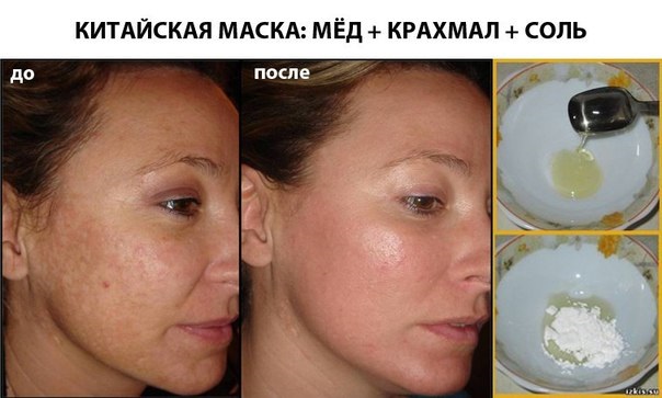 Topeng muka pati dengan kesan botox, anti-kedut, untuk kulit kering, dengan kefir, pisang, soda, garam, minyak zaitun. Resepi