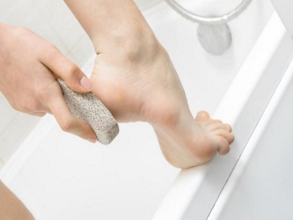 الذرة على القدمين - العلاج والتخلص السريع في المنزل. صورة
