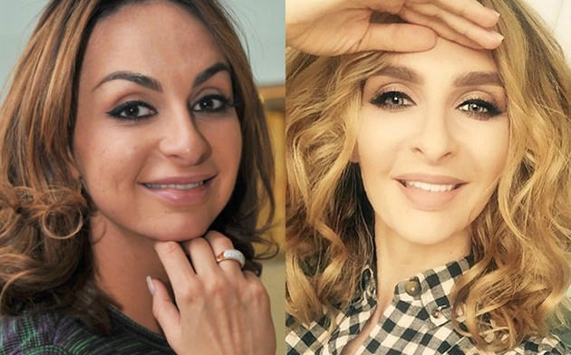 أفضل 10 نجوم فاشلين في الجراحة التجميلية. صور قبل وبعد الممثلين السوفييت والروس والأجانب وهوليوود