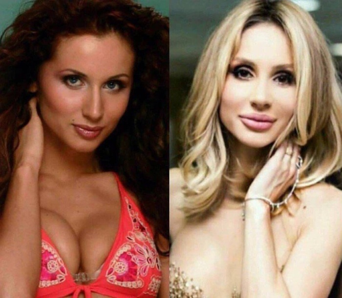 أفضل 10 نجوم فاشلين في الجراحة التجميلية. صور قبل وبعد الممثلين السوفييت والروس والأجانب وهوليوود