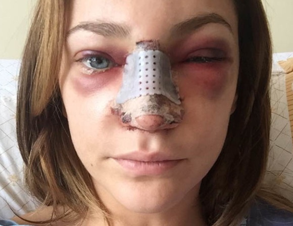أفضل 10 نجوم فاشلين في الجراحة التجميلية. صور قبل وبعد الممثلين السوفييت والروس والأجانب وهوليوود