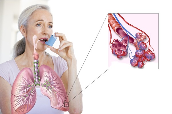 Làm sạch da mặt tại nhà. Cách làm từ mụn đầu đen, mụn bọc, mụn trứng cá bằng các bài thuốc dân gian. Công thức làm mặt nạ và tẩy tế bào chết, thiết bị sử dụng tại nhà