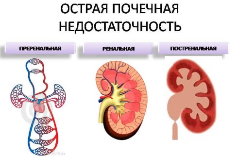 Plasmaphoresis - chỉ định sử dụng trong phụ khoa, mang thai, dị ứng, bệnh vẩy nến. Các tác dụng phụ có thể xảy ra, chi phí của thủ thuật