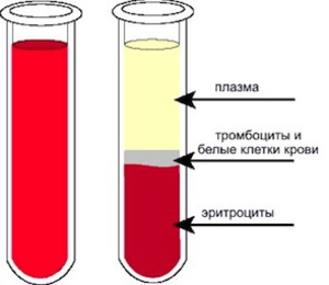 Plasmaphoresis - chỉ định sử dụng trong phụ khoa, mang thai, dị ứng, bệnh vẩy nến. Các tác dụng phụ có thể xảy ra, chi phí của thủ thuật