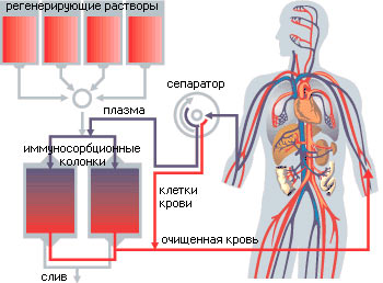 Plasmaphoresis - chỉ định sử dụng trong phụ khoa, mang thai, dị ứng, bệnh vẩy nến. Các tác dụng phụ có thể xảy ra, chi phí của thủ thuật