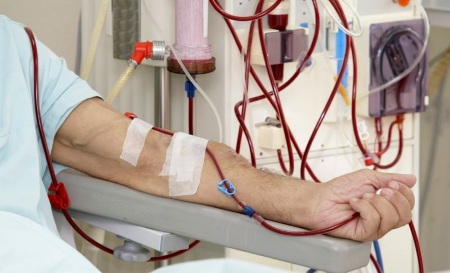Plasmaphoresis - chỉ định sử dụng trong phụ khoa, mang thai, dị ứng, bệnh vẩy nến. Các tác dụng phụ có thể xảy ra, chi phí của thủ thuật