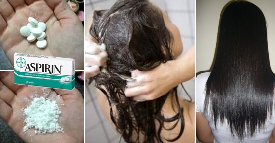 Cách trị gàu tại nhà với aspirin, soda, giấm, hành tây - dân gian. Làm thế nào để thoát khỏi một cách nhanh chóng và hiệu quả