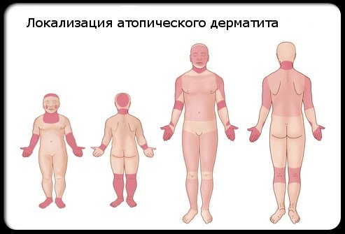 Тридерм. Упутство за употребу. Цена, аналоги, прегледи