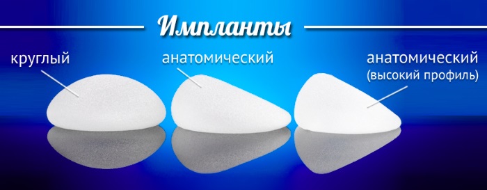 Nâng ngực. Hình ảnh trước và sau khi phẫu thuật tạo hình tuyến vú, đặc điểm thực hiện. Kem, bài tập, xoa bóp, biện pháp dân gian