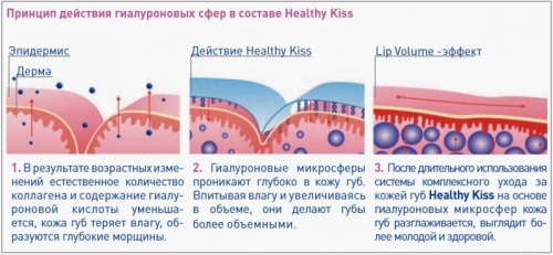 Повећање усана код куће: рецепти за маску, пилинг, хијалуронску, никотинску киселину. Вежбање, масажа, усисавање