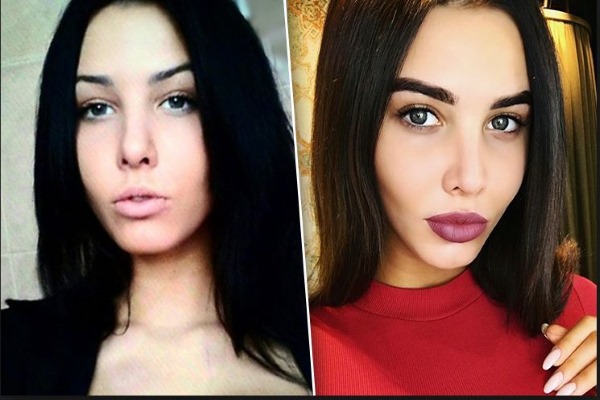 Anastasia Reshetovaภาพถ่ายก่อนและหลังการทำศัลยกรรมความสูงน้ำหนักของหญิงสาวพารามิเตอร์ของร่างกาย