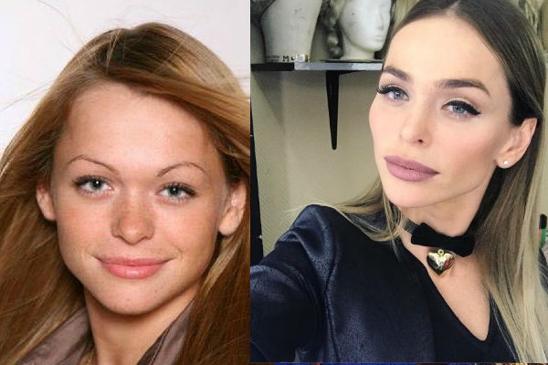 Anna Khilkevich trước và sau khi phẫu thuật thẩm mỹ, các chỉ số về chiều cao, cân nặng, hình thể. Ảnh, tiểu sử