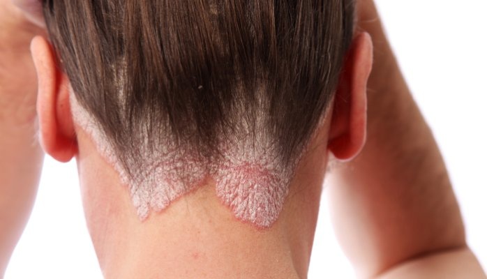 Botox cho tóc Honma Tokyo. Nhận xét, hướng dẫn sử dụng, ai phù hợp, chỉ định và chống chỉ định, hậu quả, giá cả