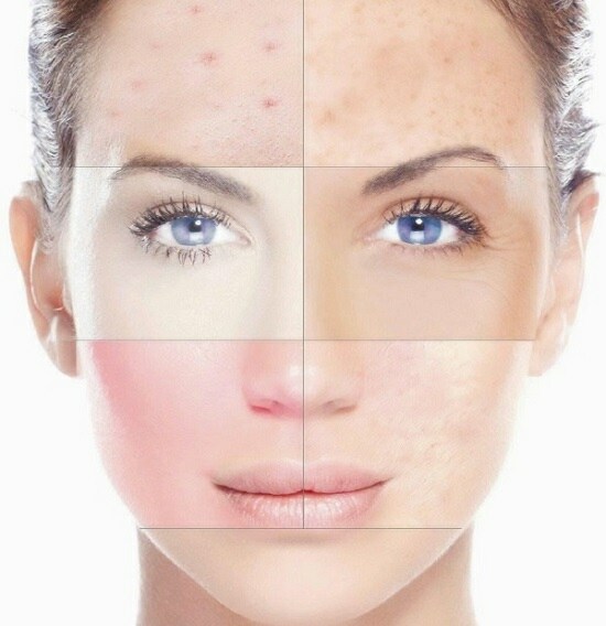 Kem dưỡng da Lora với axit hyaluronic, peptide trên khuôn mặt. Hiệu quả, đánh giá của các chuyên gia thẩm mỹ